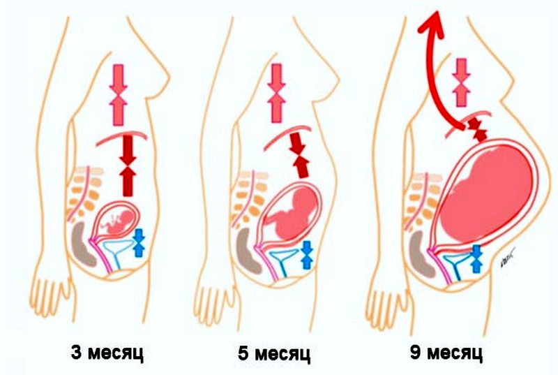 Изжога при беременности - причины, диагностика, профилактика и лечение патологии :: polismed.com