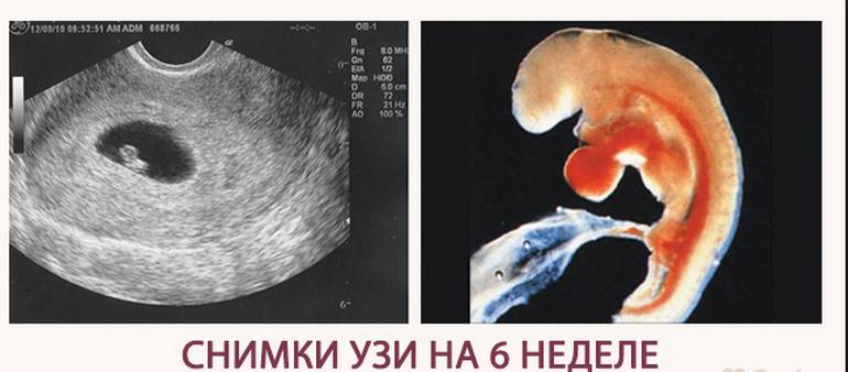 Курс 6 недель. Фото эмбриона на 6 неделе беременности на УЗИ. Эмбрион в 5 недель - 6 недель.