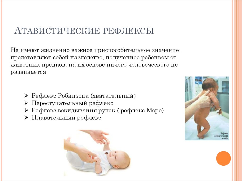 Рефлексы новорожденного: таблица, хватательный, сосательный, бабинского, бабкина, шаговый, робинсона
