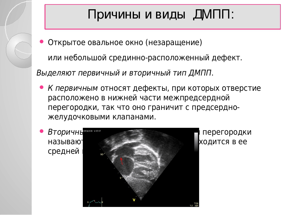 Пороки сердца врожденные и приобретенные: диагностика и лечение