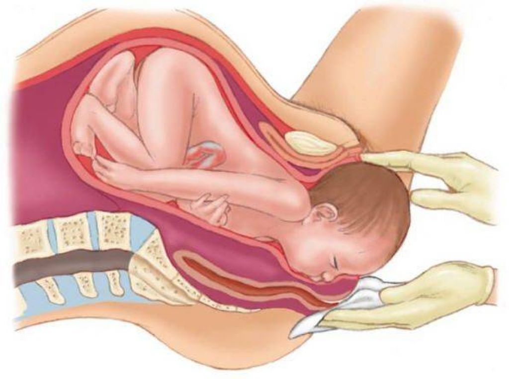 Как правильно тужиться во время родов: стоит ли делать длинную потугу или несколько маленьких, как правильно дышать на разных этапах и почему важно следовать рекомендациям акушера
