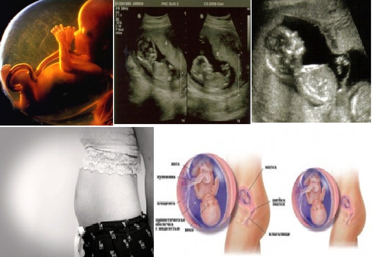 Беременность двойней по неделям, особенности беременности близнецами, развитие плода с фото |
 эко-блог