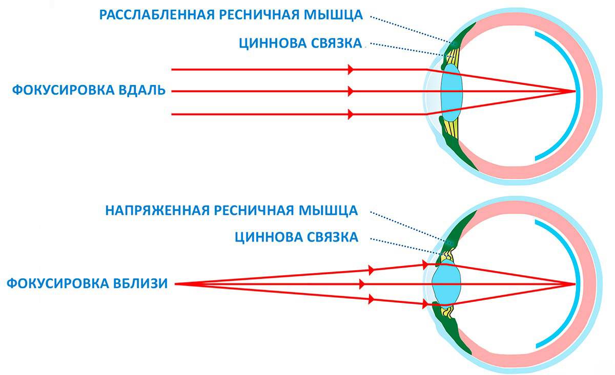 Часть глаза помогающая видеть четкое изображение на определенном расстоянии