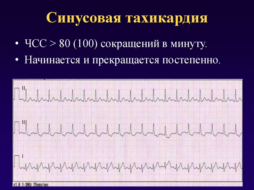 Учащенное сердцебиение картинки