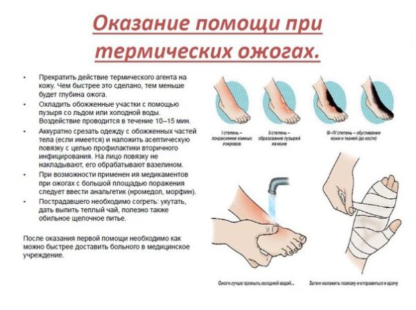 Ожог губы: признаки, виды, лечение