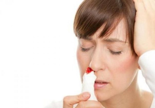 Первая помощь при носовом кровотечении - к каком врачу обратиться