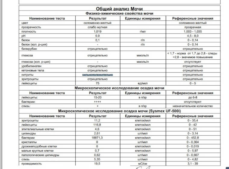 Глюкоза в моче: причины появления глюкозы в моче, прием эндокринолога в москве