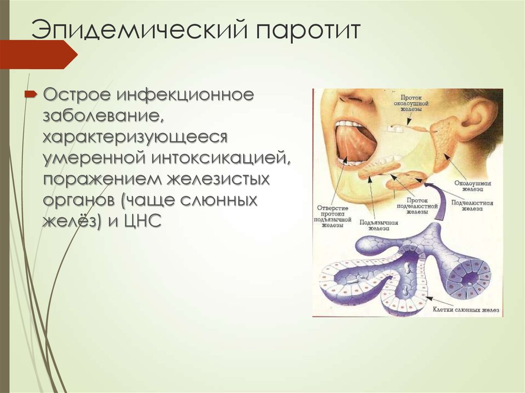 Эпидемический паротит: симптомы, диагностика, лечение