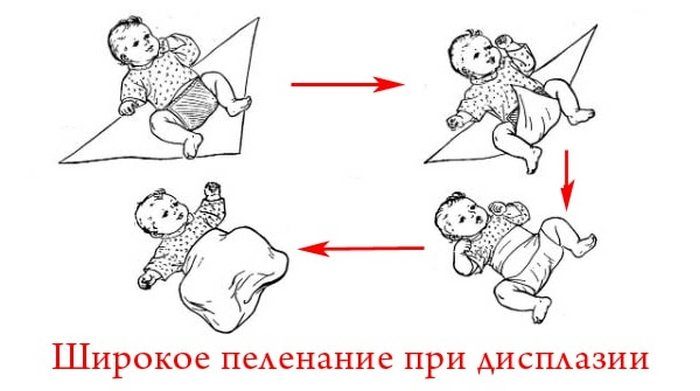 Как правильно пеленать новорожденного: обзор 7 способов и важные правила от врача-педиатра, видео