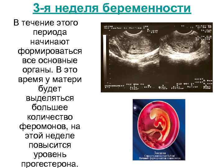 3 триместр беременности