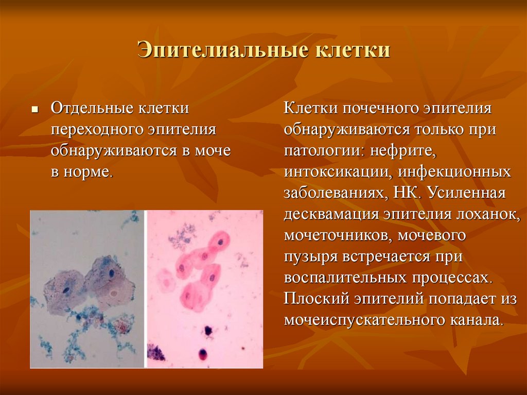 Эритроциты в моче у детей: диагностика при эритроцитах в моче у детей, осмотр уролога в москве