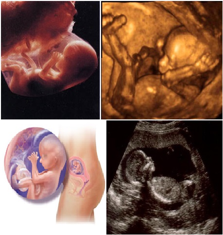 16 неделя беременности: что происходит симптомы и развитие плода