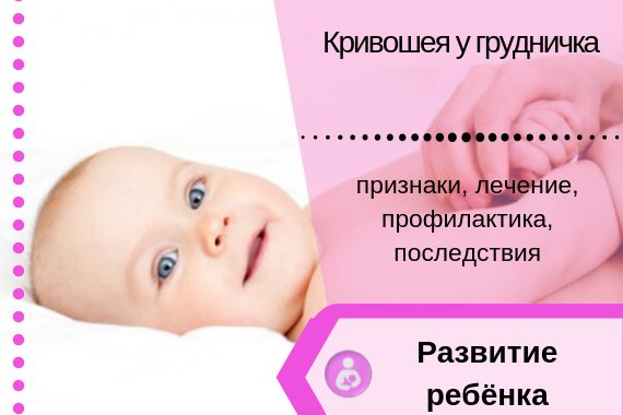 Кривошея: вызовы, с которыми сталкиваются родители новорожденных и операция в старшем возрасте | медицинский дом odrex