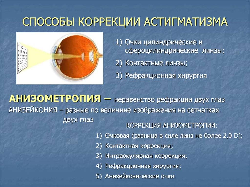 Что такое астигматизм: причины возникновения, классификация, диагностика и лечение - энциклопедия ochkov.net