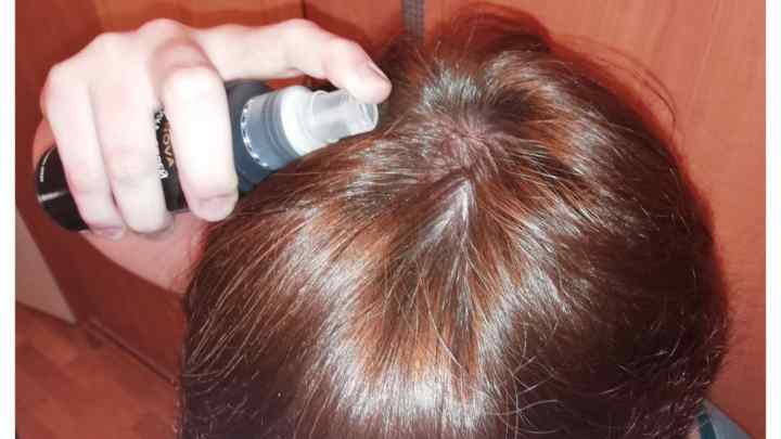 Выпадение волос после коронавируса