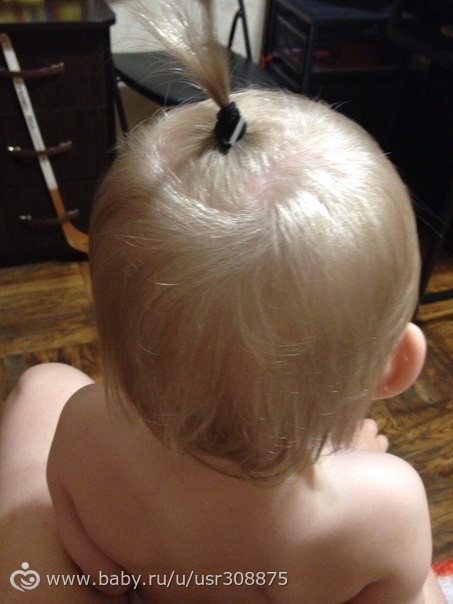У дочки плохо растут волосы что делать в домашних условиях