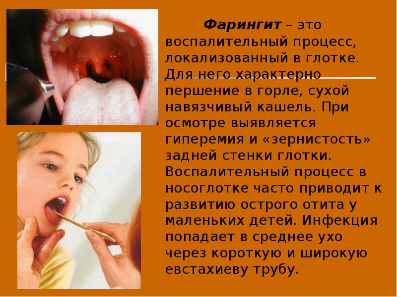 Ларингит у детей: симптомы и лечение - лор клиника №1