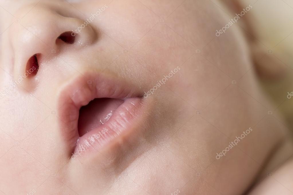 Мозоль на губе, во рту у новорожденного или взрослого: почему возникает, чем лечить, как отличить от других заболеваний