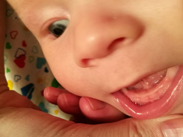 Появление первых зубов