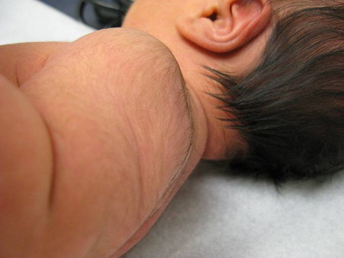 Волосы у новорожденного на ушах – норма ли это и нужно ли от них избавляться?