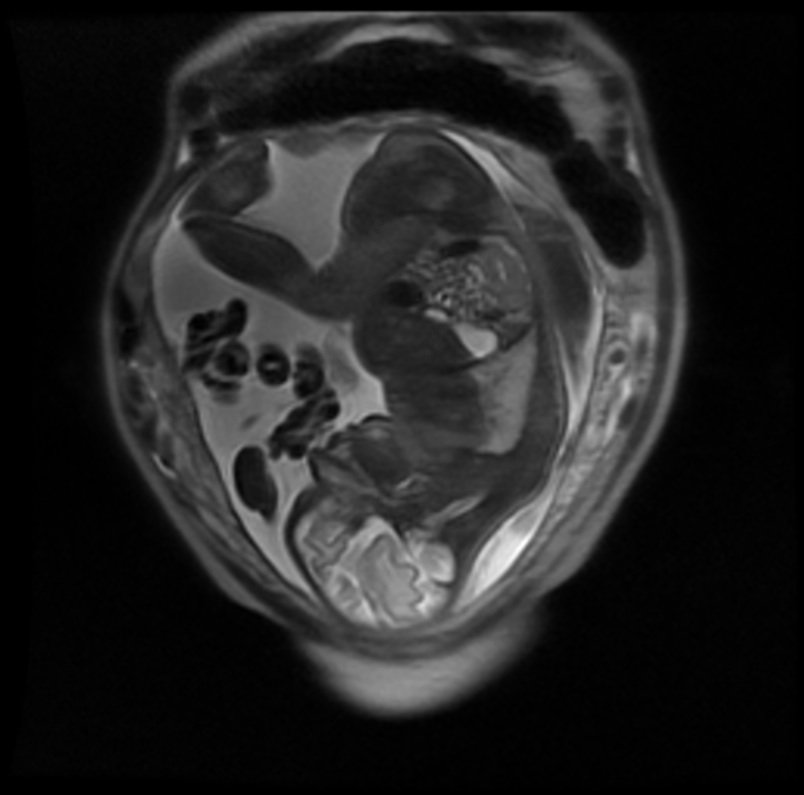 Щитовидная железа – держим под контролем - статьи от специалистов клиники «мать и дитя»