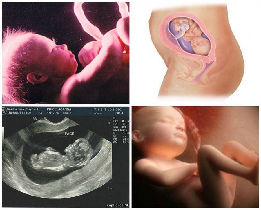 23 неделя беременности - что происходит, развитие плода, рост, вес ребенка, шевеление