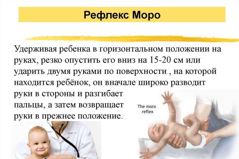 Врождённые физиологические рефлексы — википедия. что такое врождённые физиологические рефлексы