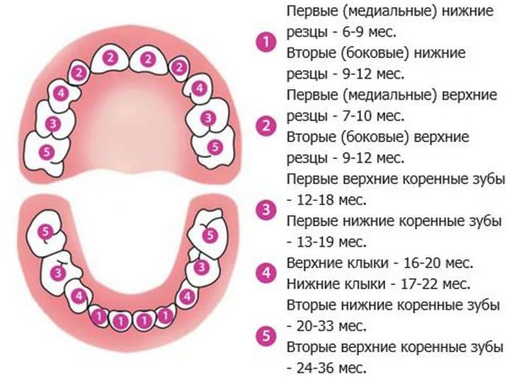 Ретинированные зубы