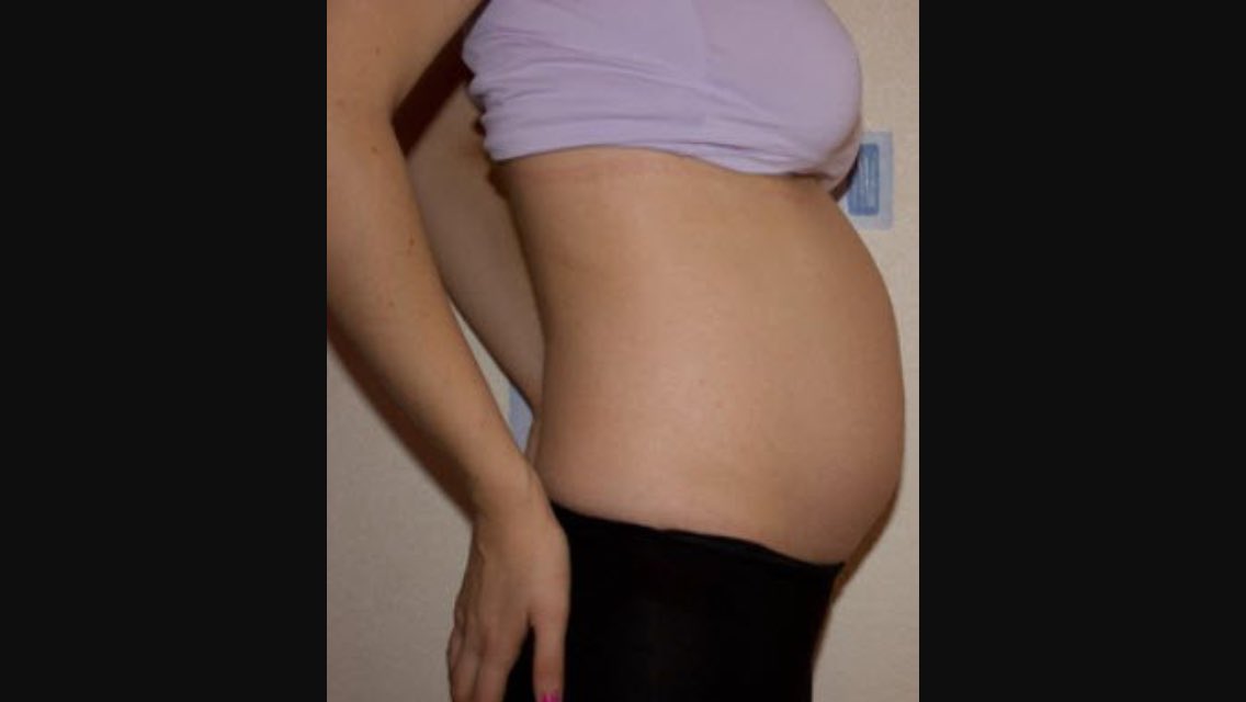 Гестоз при беременности: симптомы, лечение и рекомендации специалиста