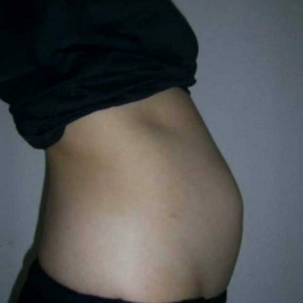 3 недели беременности после эко