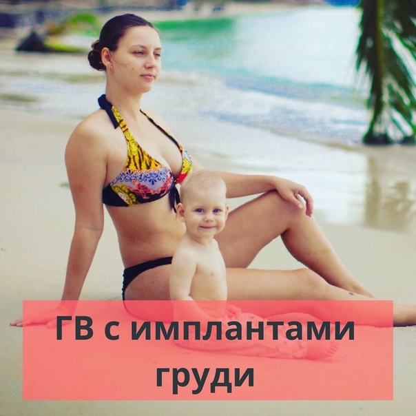 Возможно ли кормление грудью с имплантами? | маммопластика.ru