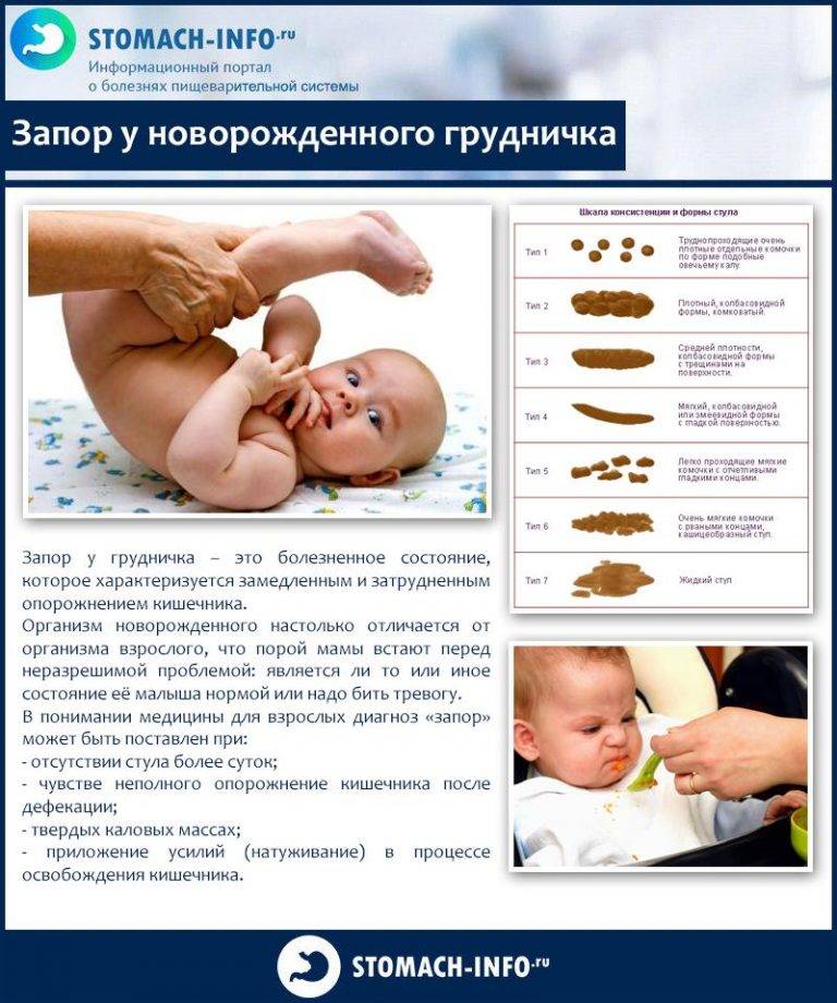 Цвет стула у ребенка: норма и отклонения. когда стоит беспокоиться