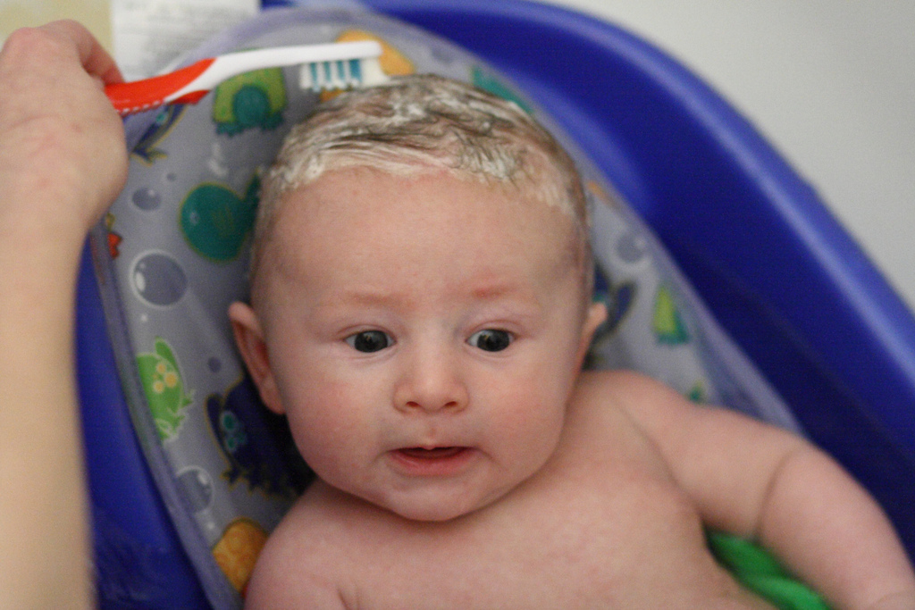 Ребенку 2-3 месяца: что делать, если шелушится кожа головы у новорожденного - детская поликлиника