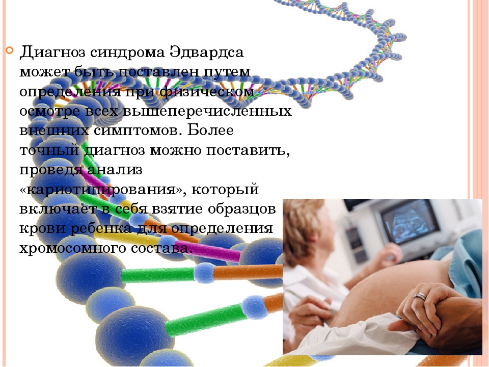 Генетический риск осложнений беременности и патологии плода: диагностика, анализ, тест | клиника «линия жизни» в москве