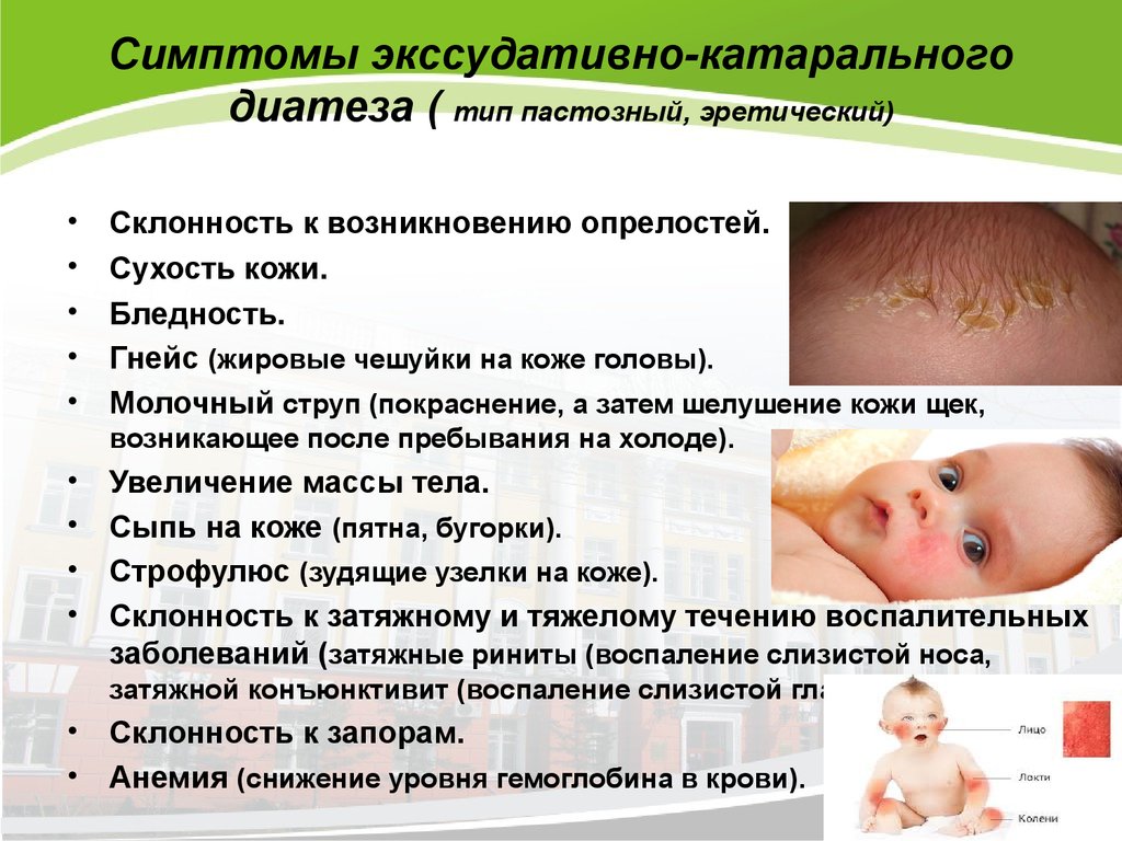 Диатез: лечение у грудничков на щеках и лице, симптомы диатеза у взрослых - поликлиника №8 город владивосток