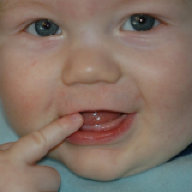 Как облегчить прорезывание зубов у детей народными средствами