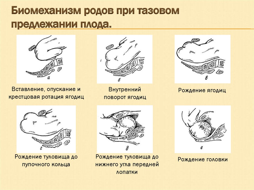 Роды схема для детей