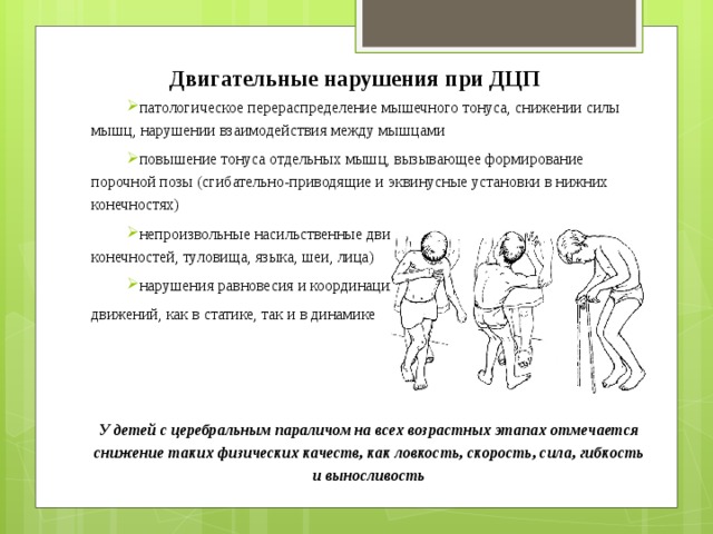 Детский церебральный паралич (дцп)
