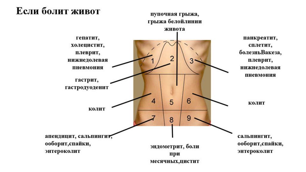 Боли в животе локализация на картинке