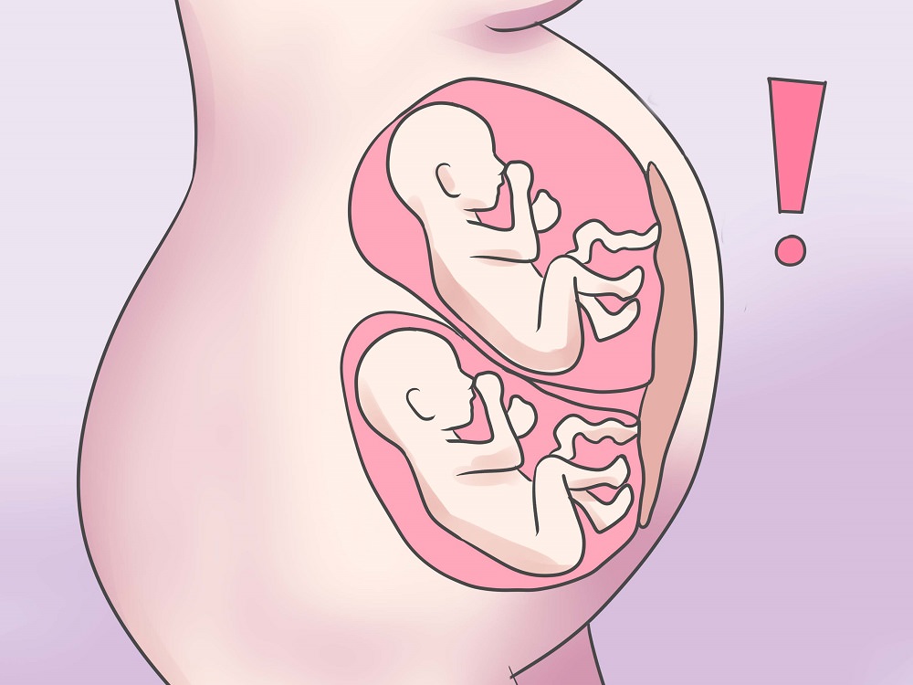 Многоплодная беременность — большая медицинская энциклопедия