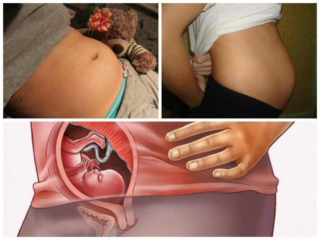 20 неделя беременности: подберите бандаж и следите за самочувствием