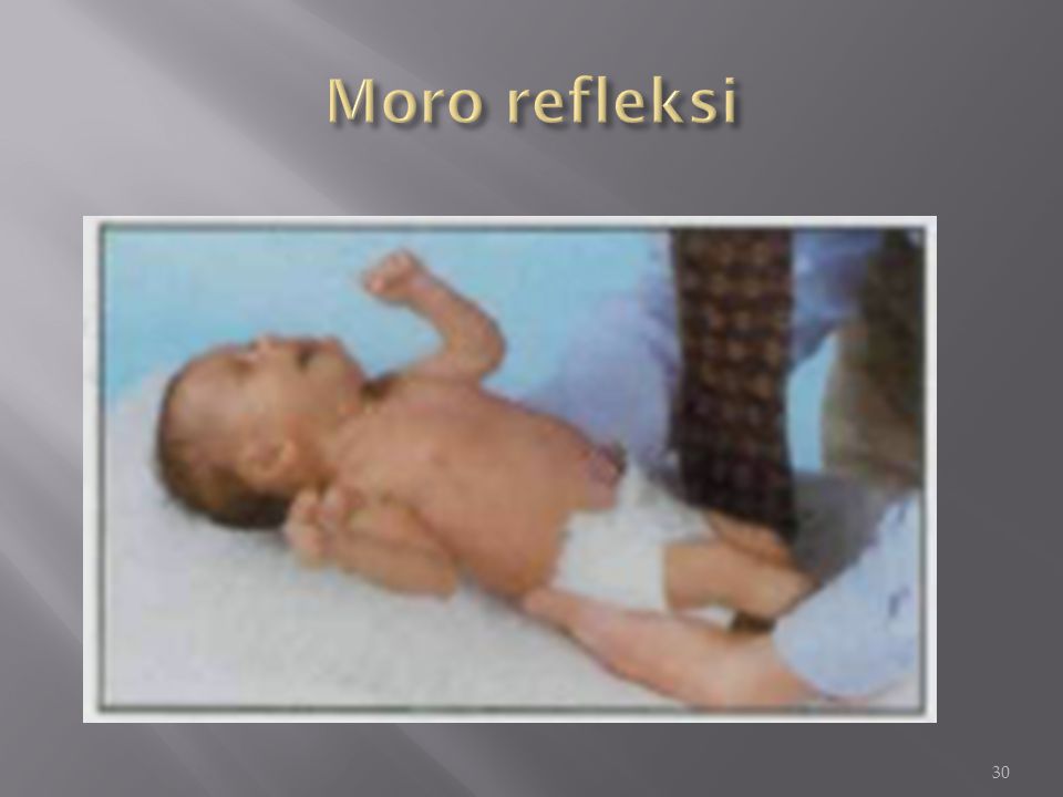 Врождённые физиологические рефлексы — википедия. что такое врождённые физиологические рефлексы