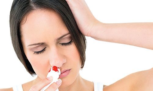 Кровотечение из носа: причины, как быстро остановить