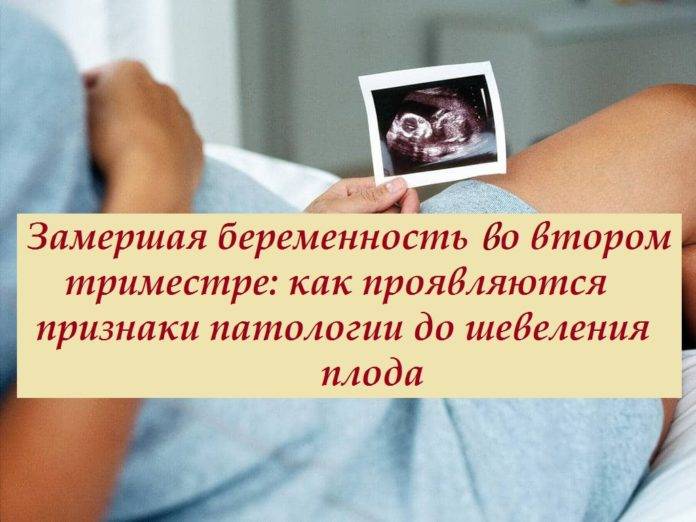 Беременность после замершей. когда можно беременеть после замершей беременности?