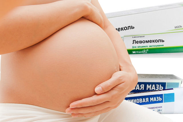 Можно ли оперировать геморрой во время беременности? | атлантик