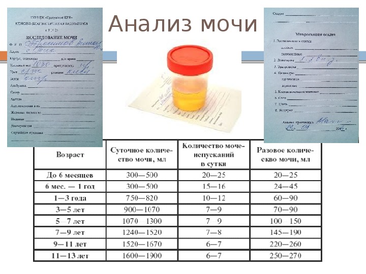 Как собрать мочу у девочки грудничка или новорожденного мальчика