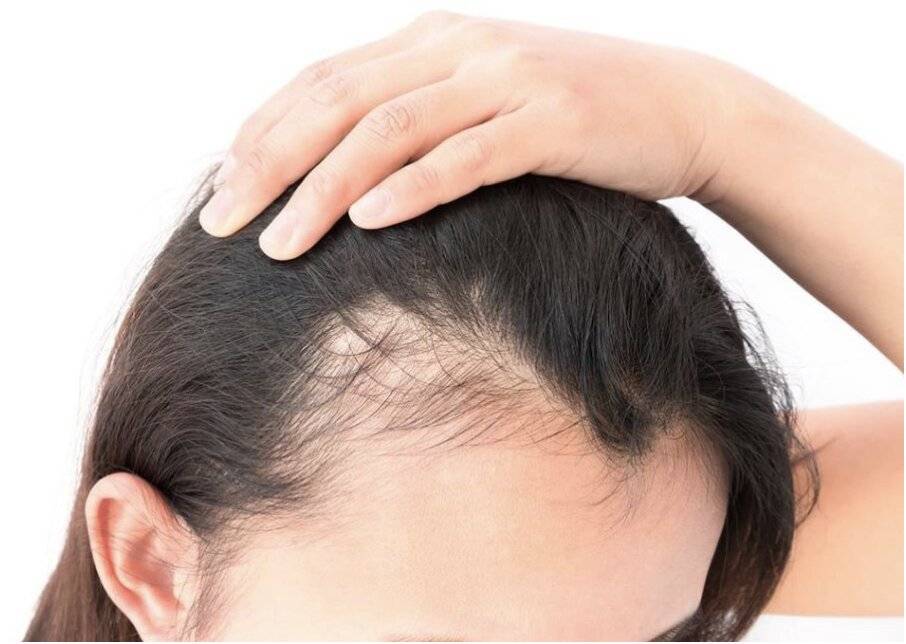 Почему сильно выпадают волосы после родов и что делать: как укрепить волосы после родов