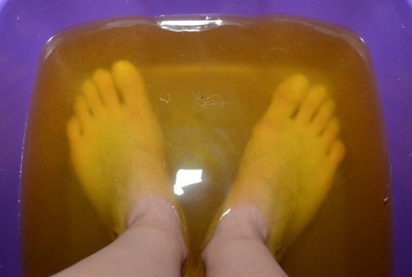 Скипидарные ванны в лечении артроза