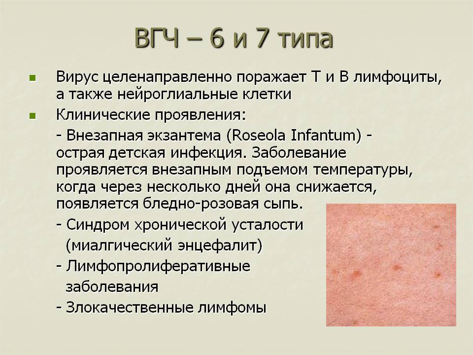 Чернобровкина т.я диагностическое значение экзантем при инфекционных заболеваниях
 - vmc verte medical clinic