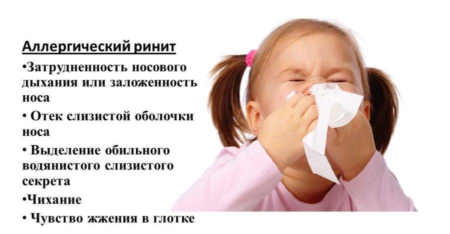 Как вылечить аллергический ринит, можно ли избавиться от заболевания навсегда